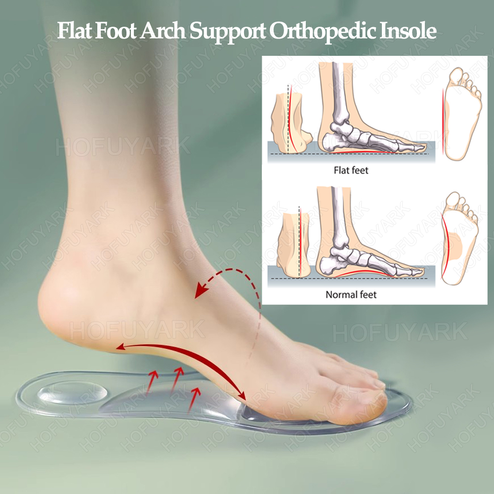 Wkładki żelowe silikonowe Orto – Women'S Shoes High Arch Support recenzja i cena